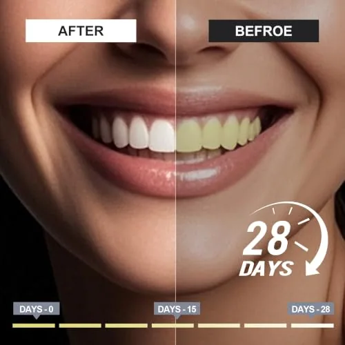 Woadee 7.5% Nano Hydroxyapatite Toothpaste